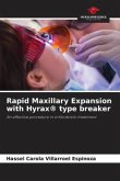 Rapid Maxillary Expansion with Hyrax® type breaker