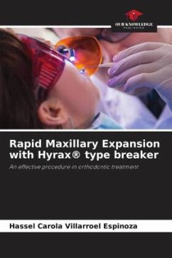 Rapid Maxillary Expansion with Hyrax® type breaker - Villarroel Espinoza, Hassel Carola