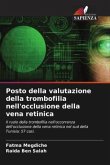 Posto della valutazione della trombofilia nell'occlusione della vena retinica