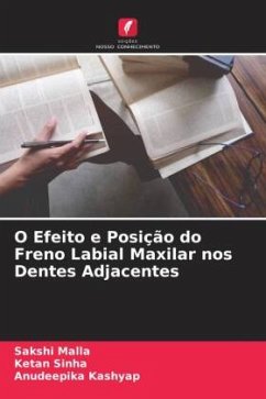 O Efeito e Posição do Freno Labial Maxilar nos Dentes Adjacentes - Malla, Sakshi;Sinha, Ketan;Kashyap, Anudeepika