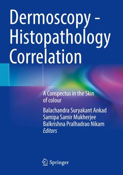 Dermoscopy - Histopathology Correlation