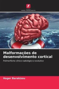 Malformações de desenvolvimento cortical - Barakizou, Hager