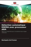 Détection automatique EDEMA avec processeur ARM