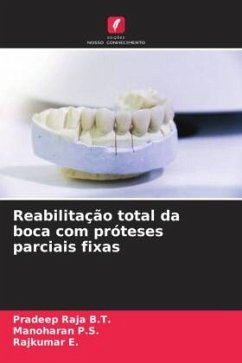 Reabilitação total da boca com próteses parciais fixas - B.T., Pradeep Raja;P.S., Manoharan;E., Rajkumar