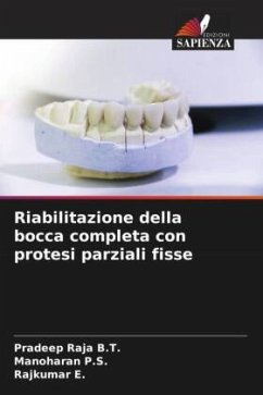 Riabilitazione della bocca completa con protesi parziali fisse - B.T., Pradeep Raja;P.S., Manoharan;E., Rajkumar