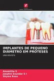 IMPLANTES DE PEQUENO DIÂMETRO EM PRÓTESES