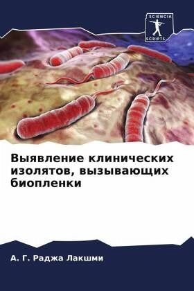 Vyqwlenie klinicheskih izolqtow, wyzywaüschih bioplenki