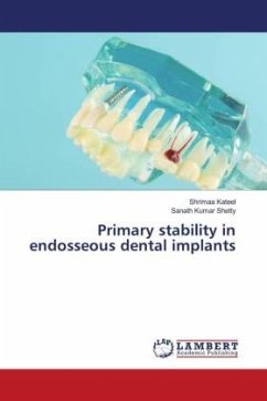 Primary stability in endosseous dental implants - Kateel, Shrimaa;Shetty, Sanath Kumar