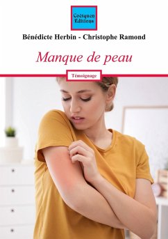 Manque de peau - Herbin, Bénédicte; Ramond, Christophe