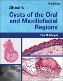 Shear's Cysts of the Oral and Maxillofacial Regions (eBook, ePUB)