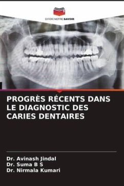 PROGRÈS RÉCENTS DANS LE DIAGNOSTIC DES CARIES DENTAIRES - Jindal, Dr. Avinash;B S, Dr. Suma;Kumari, Dr. Nirmala