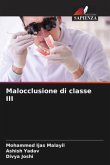 Malocclusione di classe III