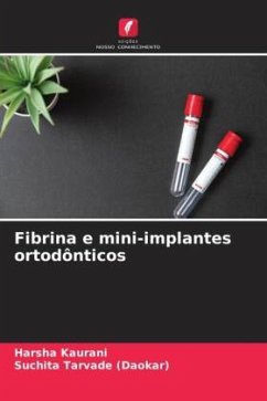 Fibrina e mini-implantes ortodônticos - Kaurani, Harsha;Tarvade (Daokar), Suchita