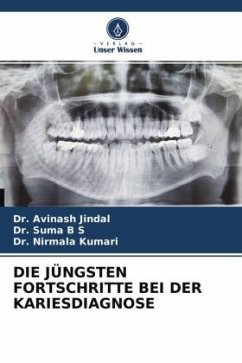 DIE JÜNGSTEN FORTSCHRITTE BEI DER KARIESDIAGNOSE - Jindal, Dr. Avinash;B S, Dr. Suma;Kumari, Dr. Nirmala
