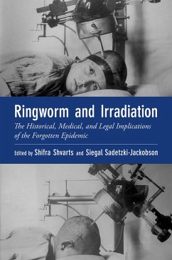 Ringworm and Irradiation (eBook, ePUB) - Shvarts, Shifra; Sadetzki, Siegal