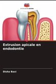 Extrusion apicale en endodontie