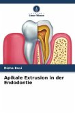 Apikale Extrusion in der Endodontie