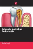 Extrusão Apical na Endodontia