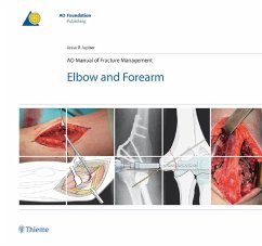 AO Manual of Fracture Management - Elbow and Forearm (eBook, ePUB) - Jupiter, Jesse