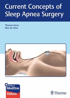 Cover Current Concepts of Sleep Apnea Surgery (eBook, ePUB)