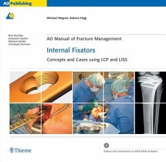 AO Manual of Fracture Management: Internal Fixators (eBook, ePUB) - Wagner, Michael; Frigg, Robert