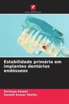 Estabilidade primária em implantes dentários endósseos - Kateel, Shrimaa;Shetty, Sanath Kumar