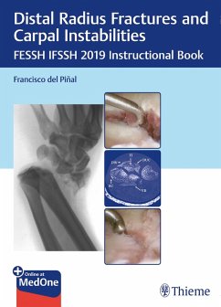 Distal Radius Fractures and Carpal Instabilities (eBook, ePUB)