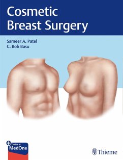 Cosmetic Breast Surgery (eBook, ePUB) - Patel, Sameer A.; Basu, C. Bob