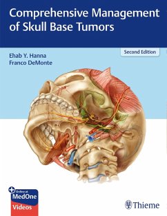 Comprehensive Management of Skull Base Tumors (eBook, ePUB) - Hanna, Ehab Y.; Demonte, Franco