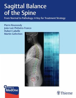 Sagittal Balance of the Spine (eBook, ePUB)
