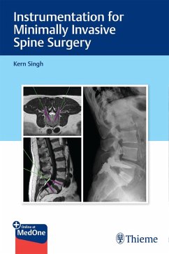 Instrumentation for Minimally Invasive Spine Surgery (eBook, ePUB) - Singh, Kern