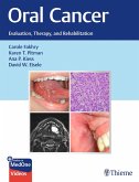 Oral Cancer (eBook, ePUB)