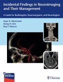 Incidental Findings in Neuroimaging and Their Management (eBook, ePUB)