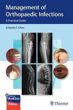 Management of Orthopaedic Infections (eBook, ePUB) - Chen, Antonia