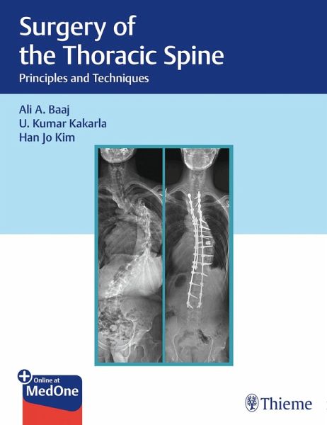 Surgery of the Thoracic Spine (eBook, ePUB)