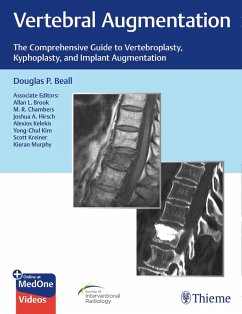 Vertebral Augmentation (eBook, ePUB) - Beall, Douglas P.