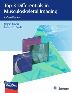 Top 3 Differentials in Musculoskeletal Imaging (eBook, ePUB) - Bindra, Jasjeet; Boutin, Robert D.