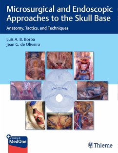 Microsurgical and Endoscopic Approaches to the Skull Base (eBook, ePUB) - Borba, Luis; de Oliveira, Jean