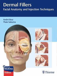 Cover Dermal Fillers (eBook, ePUB)