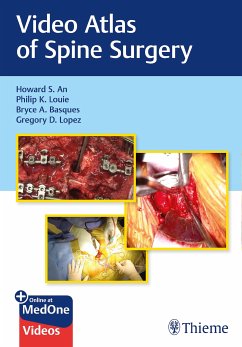 Video Atlas of Spine Surgery (eBook, ePUB) - An, Howard S.; Louie, Philip K.; Basques, Bryce; Lopez, Gregory