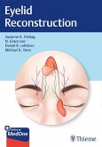 Eyelid Reconstruction (eBook, ePUB)
