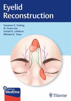 Eyelid Reconstruction (eBook, ePUB) - Freitag, Suzanne K.; Lee, Nahyoung Grace; Lefebvre, Daniel R.; Yoon, Michael K.