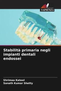 Stabilità primaria negli impianti dentali endossei - Kateel, Shrimaa;Shetty, Sanath Kumar