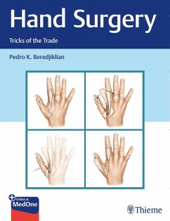 Hand Surgery (eBook, ePUB) - Beredjiklian, Pedro