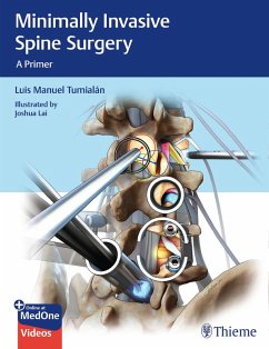 Minimally Invasive Spine Surgery (eBook, ePUB) - Tumialan, Luis Manuel