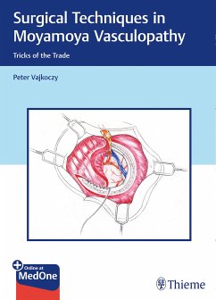Surgical Techniques in Moyamoya Vasculopathy (eBook, ePUB) - Vajkoczy, Peter