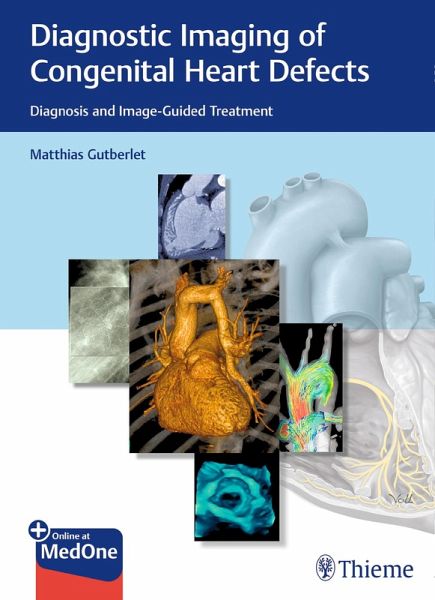 Diagnostic Imaging of Congenital Heart Defects (eBook, ePUB) Diagnostic Imaging of Congenital Heart Defects (eBook, ePUB)