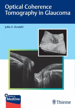 Optical Coherence Tomography in Glaucoma (eBook, PDF) - Rosdahl, Jullia