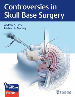 Controversies in Skull Base Surgery (eBook, ePUB) - Little, Andrew S.; Mooney, Michael A.