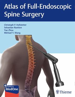 Atlas of Full-Endoscopic Spine Surgery (eBook, ePUB) - Hofstetter, Christoph; Ruetten, Sebastian; Zhou, Yue; Wang, Michael